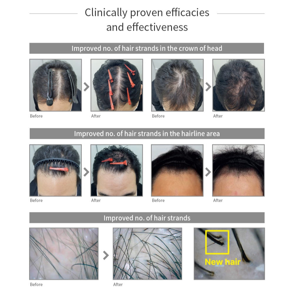 FILCORE Daily Premium Exosome Scalp and Skin
