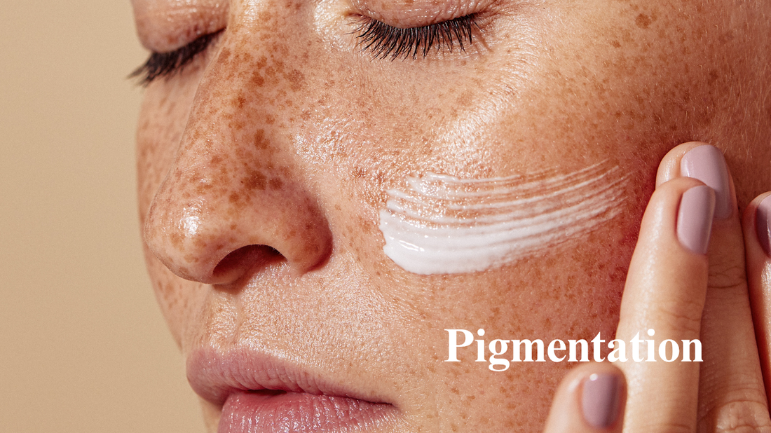 How to Treat Pigmentation Naturally: A Complete Guide to Brighter, Healthier Skin