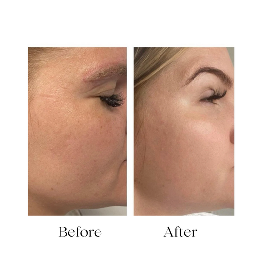 Melano Peel Cream Professional Pigmentation Care Solution