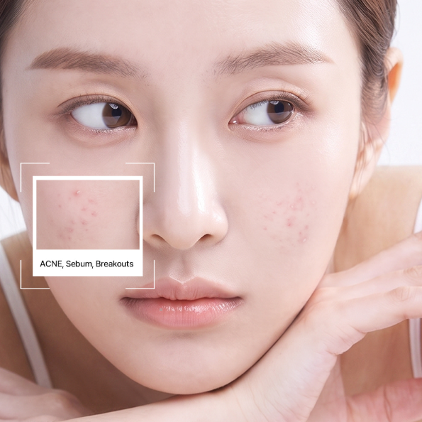 [Power A Serum] Chiyuu Dactor-Biome Anti-Blemish Calming Spot Serum