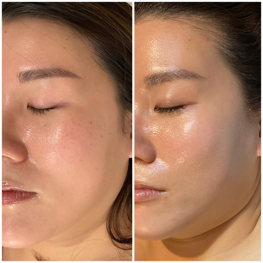 CIVASAN HY + Balsam Super Glow & Hydration Kit
